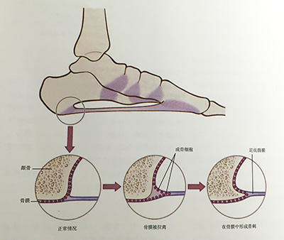 隆回长岭中医医院,隆回颈椎病,隆回腰椎病,隆回关节病,隆回风湿病,隆回股骨头坏死