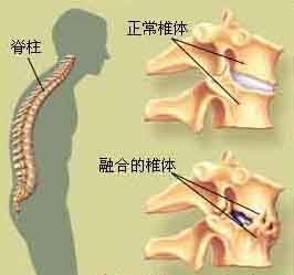 隆回长岭中医医院,隆回颈椎病,隆回腰椎病,隆回关节病,隆回风湿病,隆回股骨头坏死