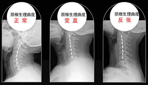 隆回长岭中医医院,隆回颈椎病,隆回腰椎病,隆回关节病,隆回风湿病,隆回股骨头坏死